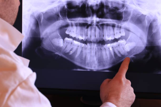 Best Emergency Denture Repair in Ragland, AL